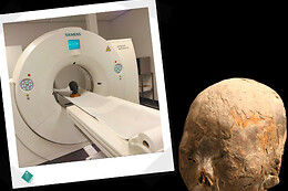 Musée de la Médecine Bruxelles